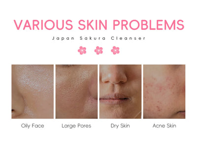 Sakura Cleanser Rich Foam Deep Clean Remove Grease Improve Oily Face Wash Cream Gentle Moisturizing Remove Blackhead CleanserSak