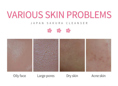 LAIKOU Facial Foaming Cleanser Deeply Cleansing Oil Control Moisturizing Blackhead Removal Skin Care Face Wash Foam Cleanser